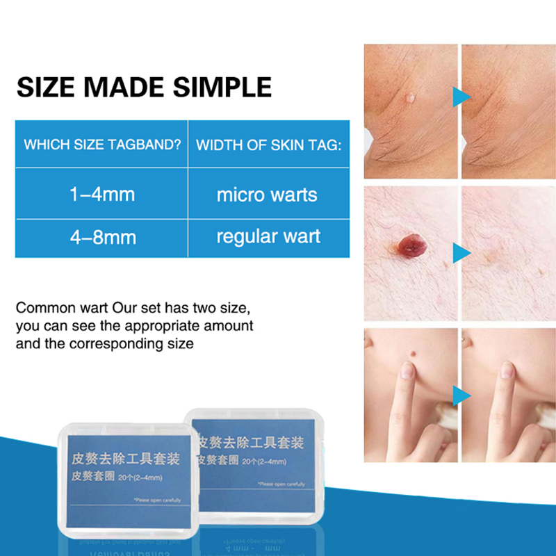 20pcs/Box Flesh Nevus Removal  - Men Accessories Kit review and price